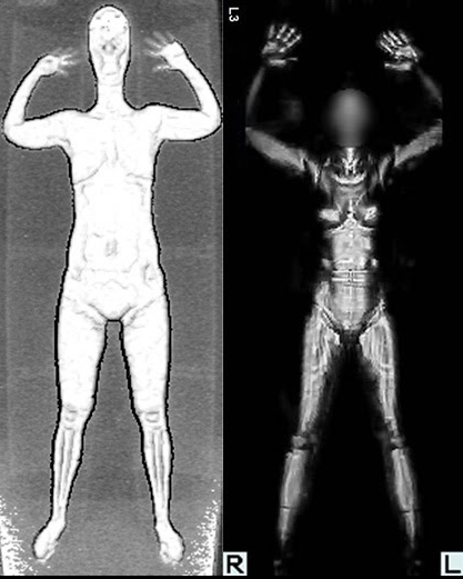 nude Airport body scan