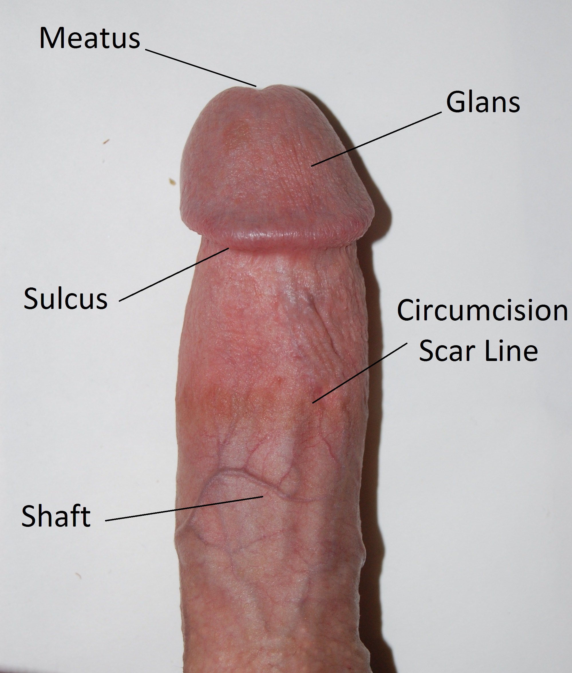 Penis Pictures of