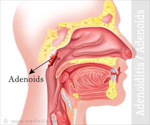 adenoids adult Enlarged