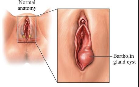 sex after lips Vagina swollen