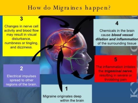 migraine Does sex trigger