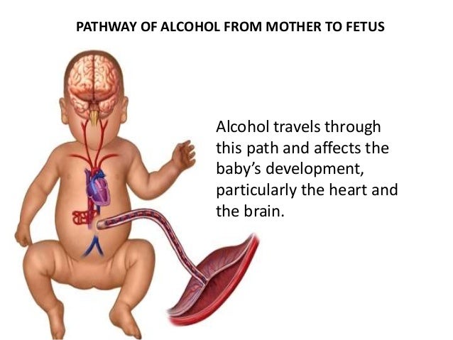 with alcohol Adult syndrome fetal